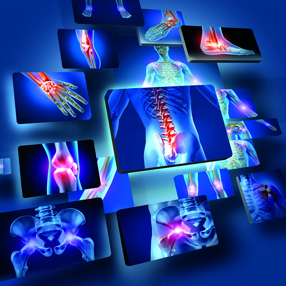 Ob Schulter, Hüfte oder Knie: Arthrose – Osteoarthritis – ist eine der häufigsten rheumatischen Erkrankungen, die zu chronischen Schmerzen führen kann. © Sebastian Kaulitzki / shuttestock.com