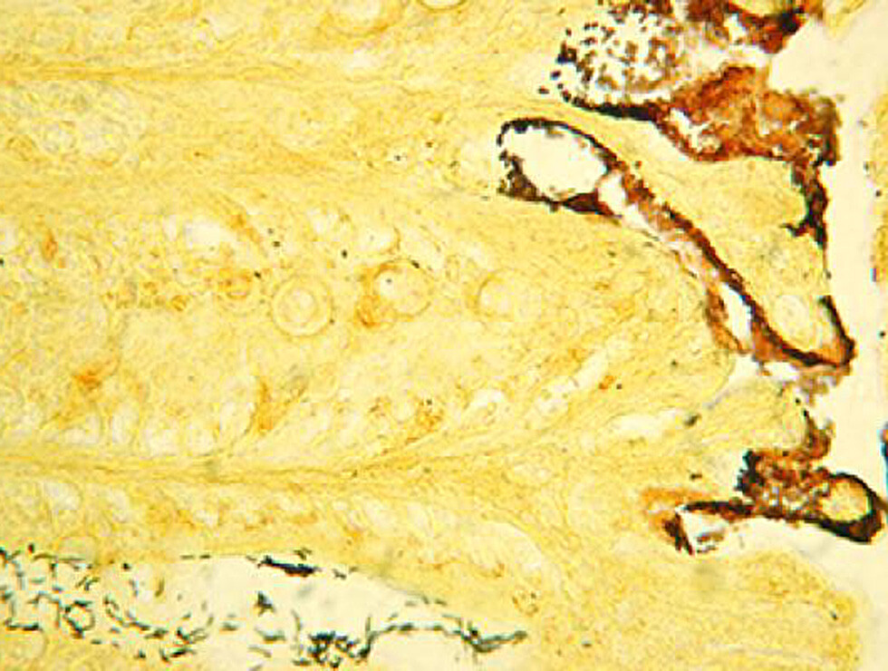 Darminfektionen mit Citrobacter rodentium Bakterienzellen (rötlich-braun), die den Dickdarm bevölkern. © Bry laboratory