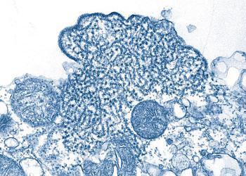 Nipah-Virus von CDC/ C. S. Goldsmith, P. E. Rollin - [1] (CDC). Lizenziert unter Public domain über Wikimedia Commons