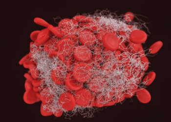Arterielle Thrombose bezeichnet die Bildung eines Blutgerinnsels (Thrombus) in einer Schlagader (Arterie). © somersault1824 / shutterstock.com