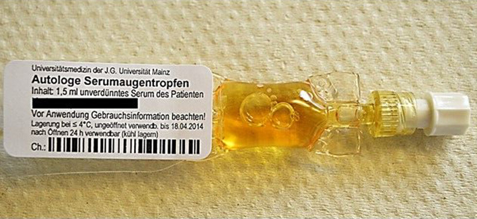 Serumaugentropfen in circa 14.000 Einzeldosis-Ophtiolen produziert die Transfusionszentrale der Universitätsmedizin Mainz gegenwärtig pro Jahr. © Transfusionszentrale der Universitätsmedizin Mainz