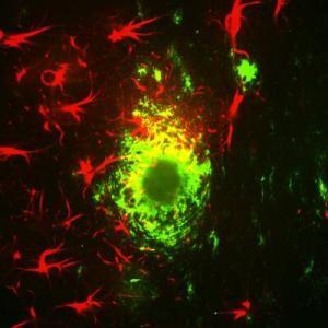 Sternförmige, rote Gliazellen im Cortex umgeben Beta-Amyloid-Plaque im Alzheimer-Mausmodell. © Strittmatter lab/Yale