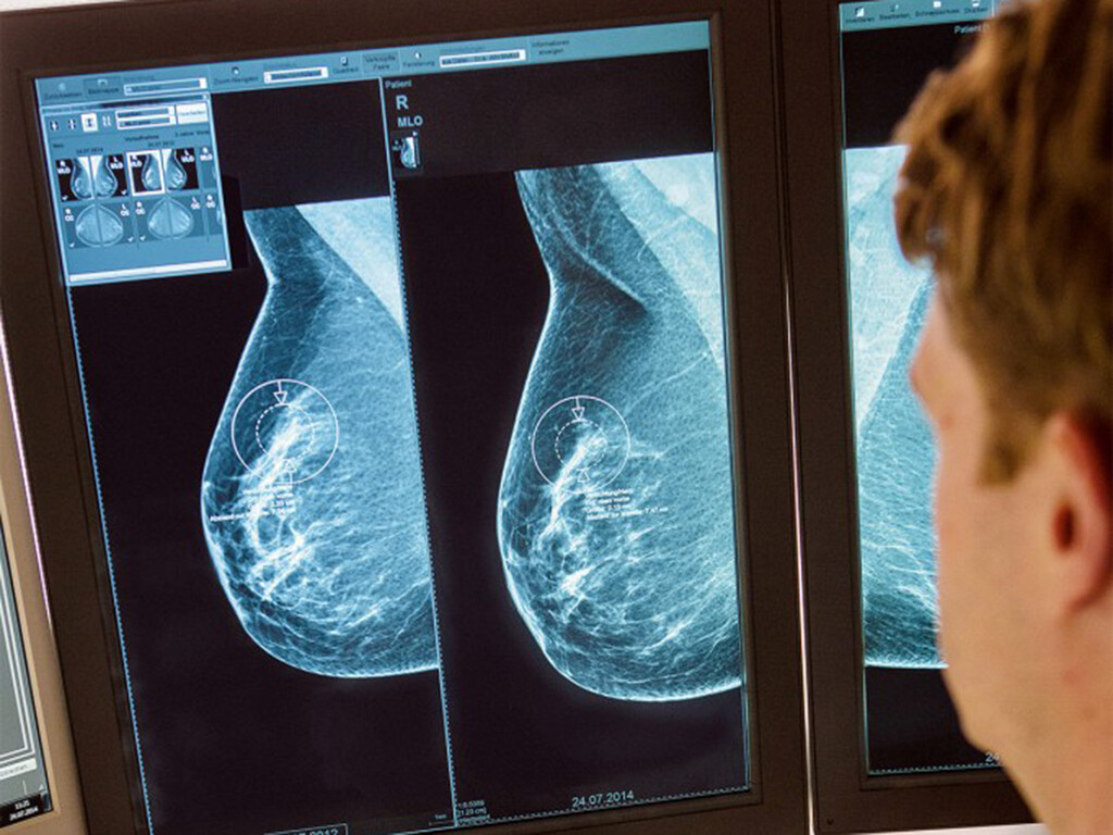 Mammographie-Screenings im Programm zur Brustkrebs-Früherkennung © Mammographie-Screening Programm