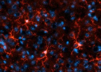 Mikroglia-Zellen (rot) bauen nach einer Schlaganfall Subarachnoidalblutung Häm ab und bilden dabei Kohlenmonoxid. Können sie das nicht, verbessert die externe Gabe die Erholung der Hirnzellen. Blau: Nervenzell-Kerne. © Nils Schallner / Universitätsklinikum Freiburg