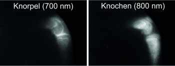 Amerikanische und südkoreanische Wissenschaftler entwickeln Fluorophore als Kontrastmittel, um Knorpelgewebe mit ausgezeichetem Signal-Rausch-Verhältnis abzubilden. © Wiley-VCH
