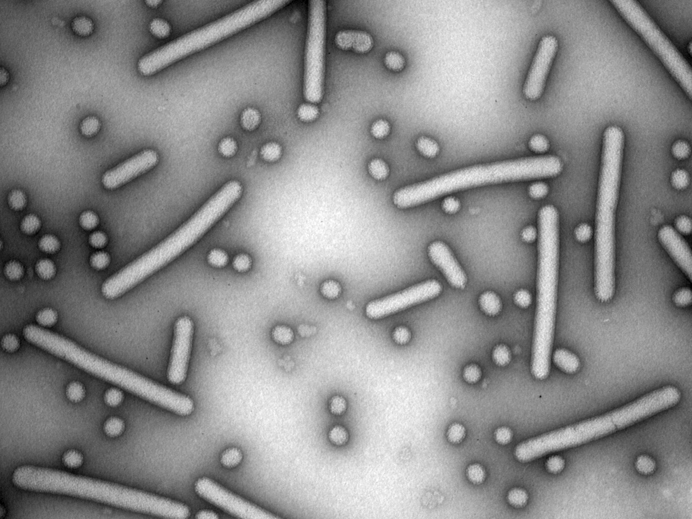 Elektronenmikroskopische Aufnahme des Jonchet-Virus. „Jonchet“ bedeutet auf Französisch Stäbchen. © Marco Marklewitz/UKB