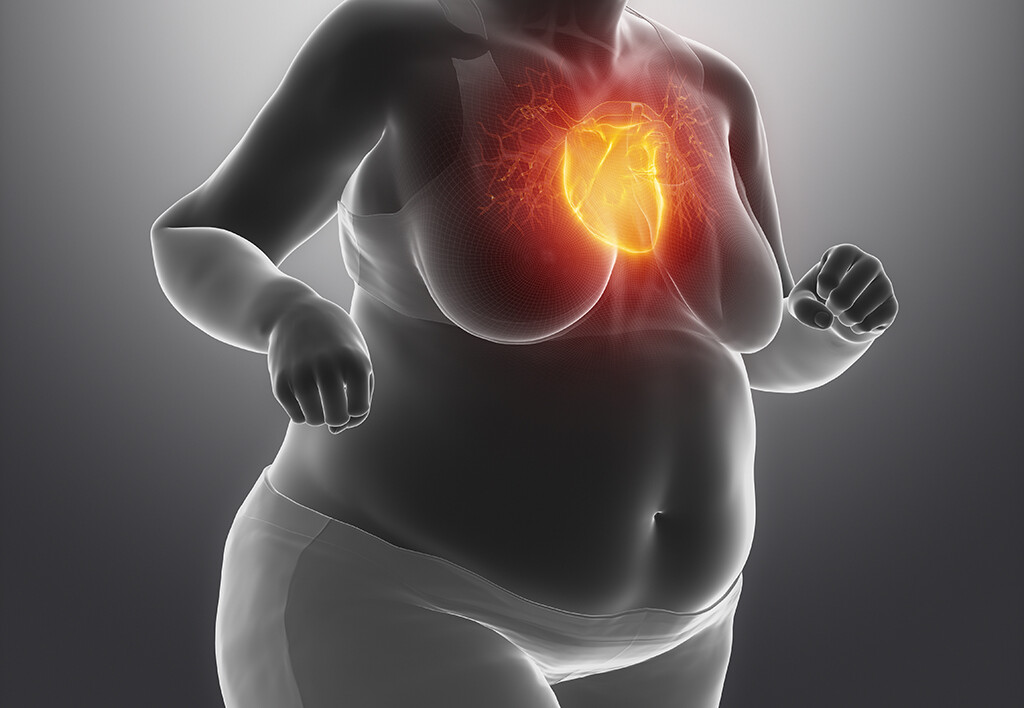 Auch Adipositas der Frau bedeutet ein höheres Risiko für eine koronare Herzkrankheit. © CLIPAREA l Custom media / shutterstock.com