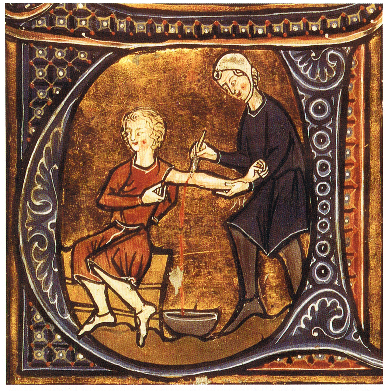 In der Geschichte der Medizin waren Klistiere und Aderlässe zweifelhafte Therapieversuche.