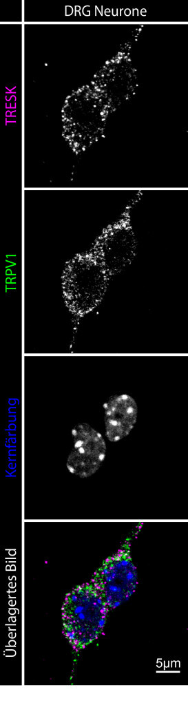 Kolokalisation vom Kaliumkanal TRESK und vom Kaliumkanal TRPV1 in sensorischen Neuronen aus Spinalganglien (DRG). © Fluoreszenzaufnahme: AG Wischmeyer