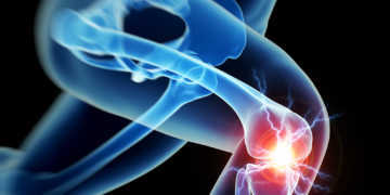 Die Sinnhaftigkeit der Anwendung einer Spritze zur Injektion von Hyaluronsäure bei Arthrose der Kniegelenke wird in jüngsten Untersuchungen bestätigt. © Sebastian Kaulitzki / shutterstock.com