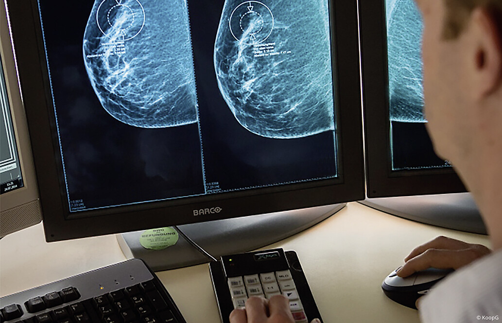 Mammographie und Ultraschall bei dichter Brust effektiver. © KoopG