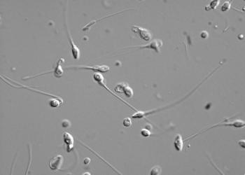 Mikroskopaufnahme von Samenzellen zeigen geringere Spermienqualität bei Adipositas. © Kinderwunschzentrum