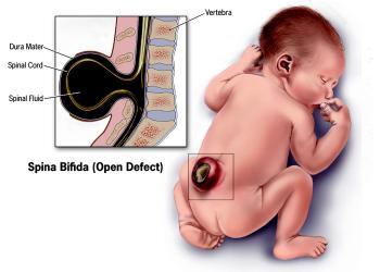 Voraussetzung für eine frühe Diagnose der Spina bifida sind Know-how und eine moderne hochauflösende Ultraschall-Technik. © Centers for Disease Control and Prevention