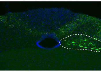 Für die aktuelle Studie schleusten DZNE-Forscher den Bauplan der menschlichen Variante von Alpha-Synuclein in die Nervenzellen – siehe gestrichelte Linie – von Mäusen. © DZNE / M. Helwig