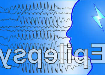 Epilepsie-Anfälle entstehen durch eine plötzliche extreme Aktivitätssteigerung der Nervenzellen, die man wie ein Gewitter oder Kurzschluss im Gehirn sehen könnte. © Stephan Oppliger / shutterstock.com
