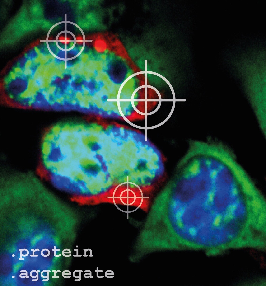 Damit Proteinaggregate (rot) in den Zellen unter dem Mikroskop sichtbar sind, müssen sie angefärbt werden. Zellkerne wurden blau, und mRNAs, die Bauanleitung für Proteine, wurden grün angefärbt. Andreas Woerner © MPI für Biochemie