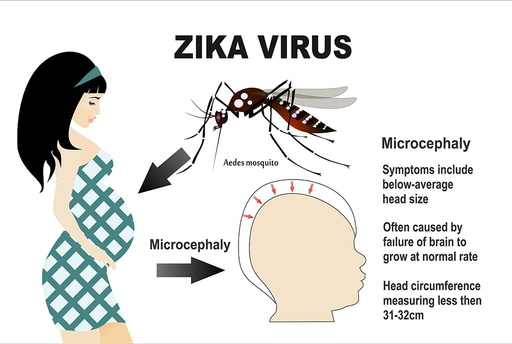 Bedrohung durch das Zika-Virus. © Tetiana Yurchenko / shutterstock.com