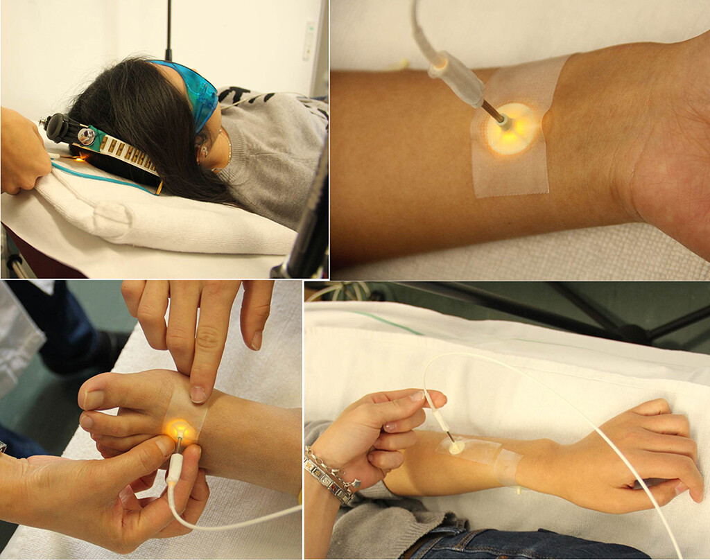 Anwendung der Laserakupunktur © Med Uni Graz