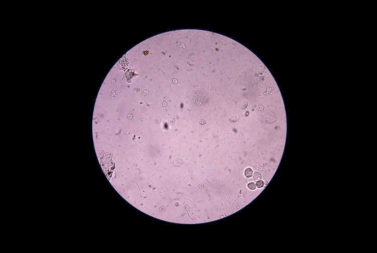 E Coli-bakterien Im Urin Welches Antibiotikum