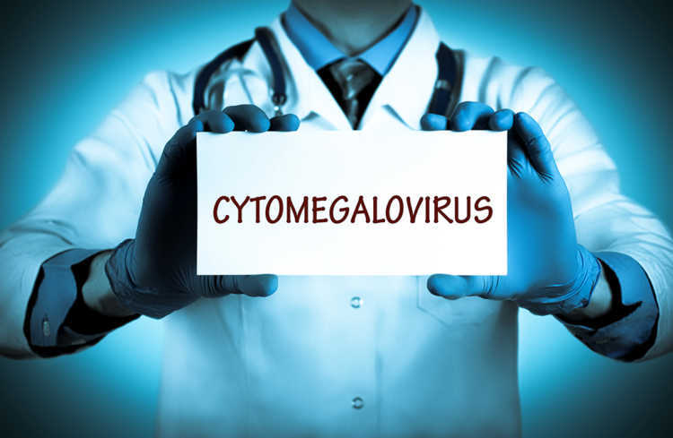 Zytomegalie durch das Cytomegalievirus MedMix