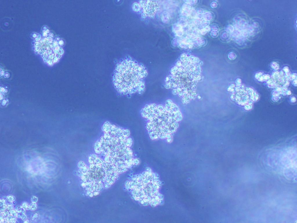 Krebszellen wachsen sehr schnell und bilden Aggregate im Zellkulturversuch. © Iris Uras/Vetmeduni Vienna