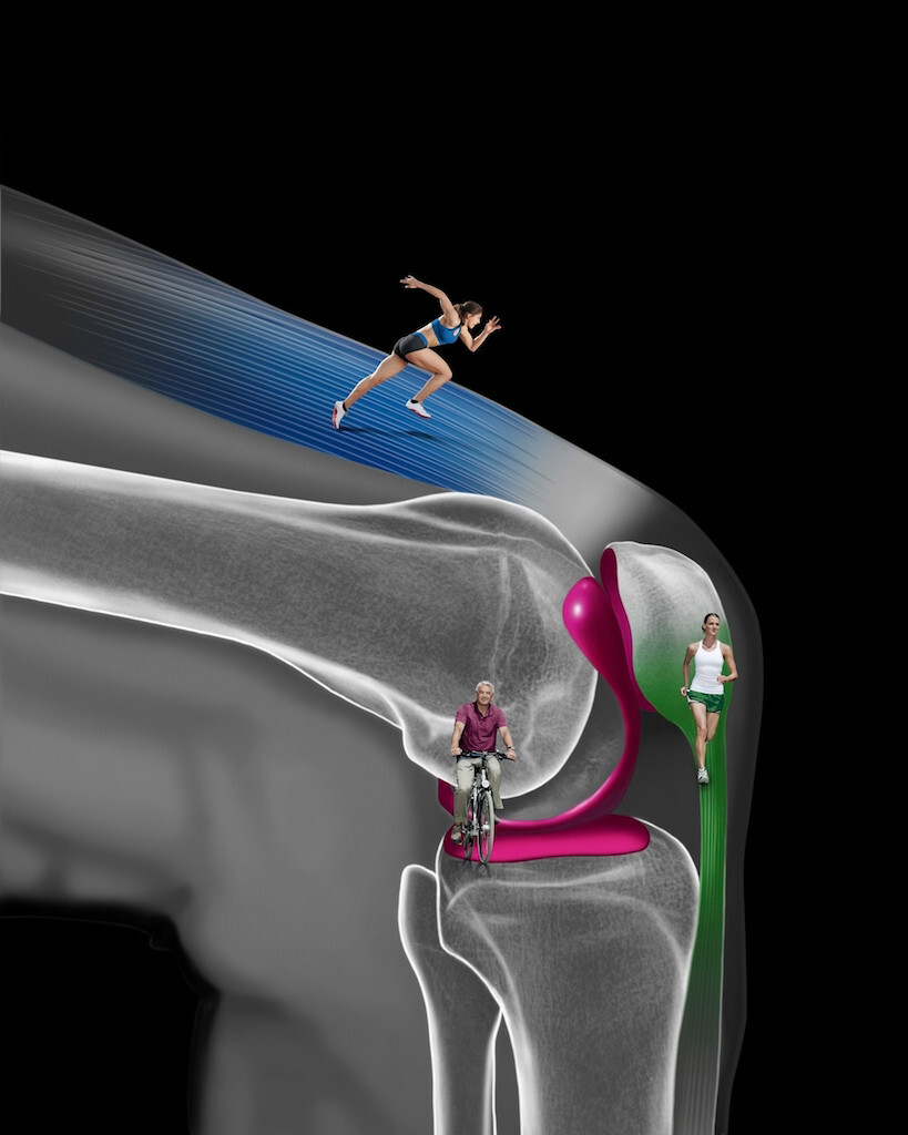 Modell Kniegelenk mit Belastungsbeispielen © Orthomol_JNB McCann Healthcare GmbH RM