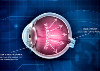 Erhöhter Augeninnendruck ist der bedeutendste Risikofaktor für ein Glaukom – der Augenerkrankung Grüner Star. © Tefi 7 shutterstock.com