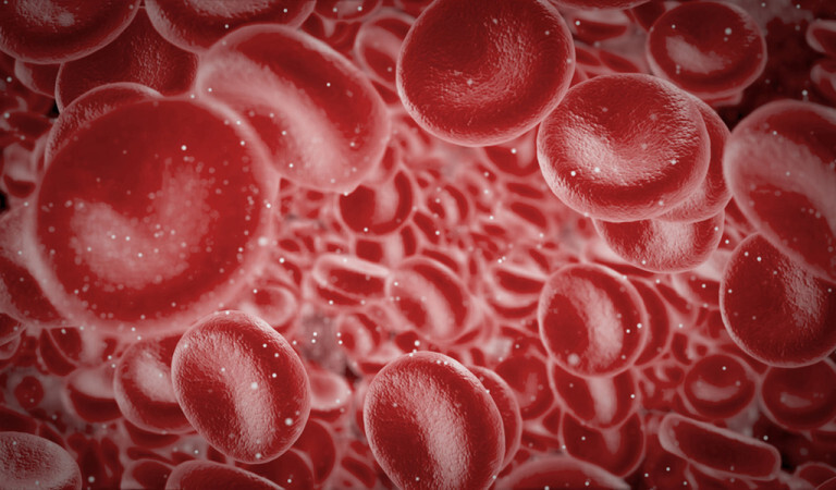 Laktatazidose gefürchtete metabolische Komplikation bei Diabetes