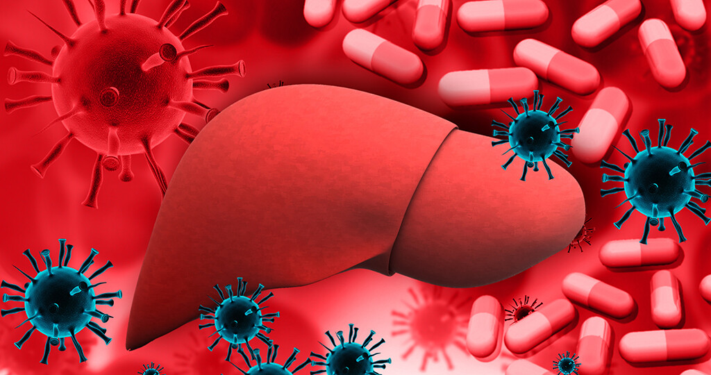 Hepatitis. © bluebay / shutterstock.com