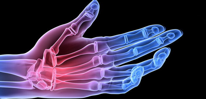 Das Outcome Measurement mit Integration mehrerer Messinstrumente ist aufgrund der Komplexität der Rheumatoiden Arthritis wichtig für eine sinnvolle Beurteilung von Therapieerfolgen. © Sebastian Kaulitzki / shutterstock.com
