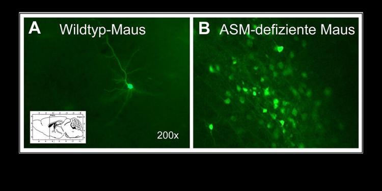 Abb. 1: Im Vergleich zu Masernvirus-infizierten Hirnen normaler Mäuse (A), in denen nach 28 Tagen nur wenige Neurone infiziert sind (grün fluoreszierend), sind aufgrund der eingeschränkten Immunantwort in ASM-defizienten Mäusen wesentlich mehr Neurone infiziert (B). © Uni Würzburg / Schaulies-Schneider
