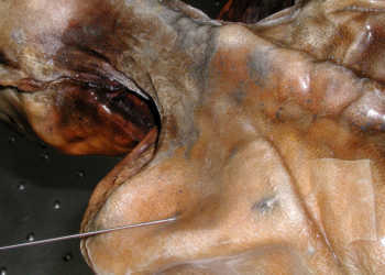 Pfeilspitze in Ötzi. © Südtiroler Archäologiemuseum / Museo Archeologico dell’Alto Adige