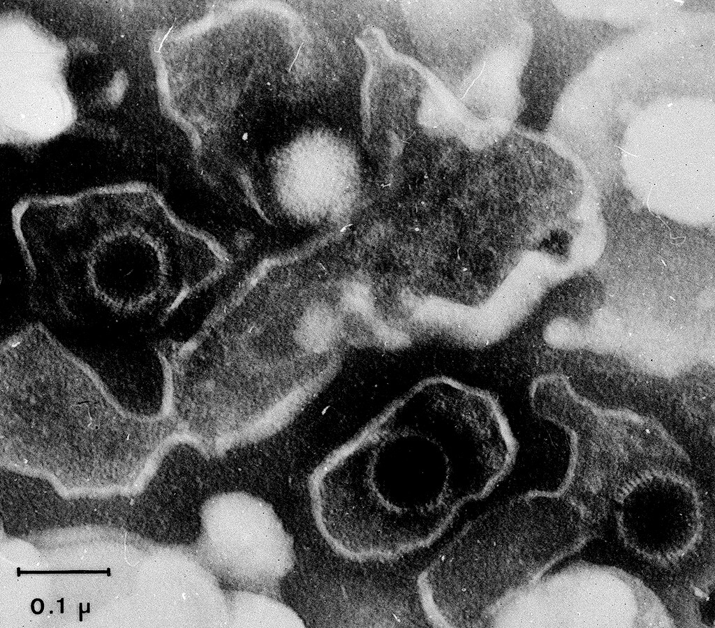 Das Epstein-Barr-Virus (EBV) hindert infizierte Zellen daran, sich beim Immunsystem bemerkbar zu machen. © Prof. Georg Bornkamm / Helmholtz Zentrum München