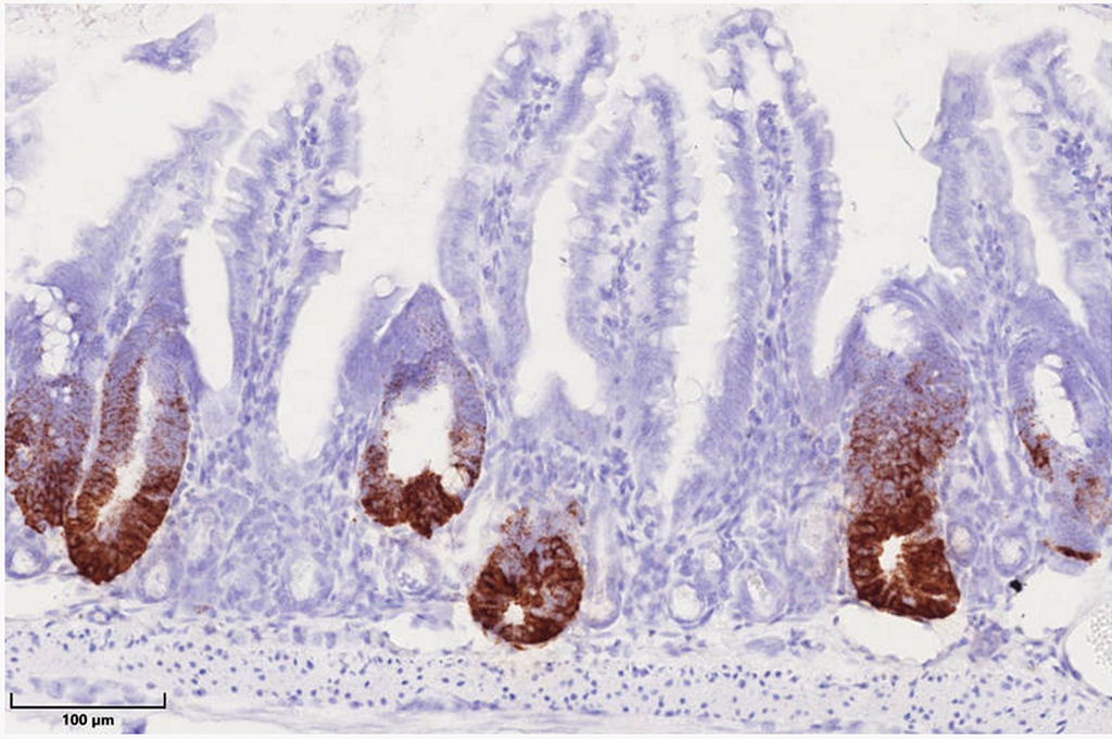 Das Hitzeschockprotein 60 in Mitochondrien kontrolliert die Stammzellproliferation im Darmepithel. Hitzeschockprotein-negative Krypten im Darm zeichnen sich durch den Verlust von braungefärbten Stammzellen aus, während Hitzeschockprotein-positive Darmareale eine verstärkte Stammzellproliferation zeigen. © Team Haller / TUM