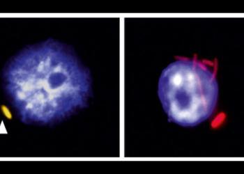 Links ein Makrophage (Zellkern in blau), in dem eine Salmonelle (gelb) ruht. Rechts ein Makrophage, in dem sich die Bakterien (rot) vermehrt haben. © Antoine-Emmanuel Saliba