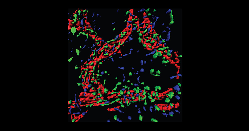 Immunzellen wandern auf ein Lymphgefäß (rot) zu; unbehandelte Zellen enthalten Semaphorin 4A (grün), bei den anderen ist es entfernt (blau). © AG Worzfeld