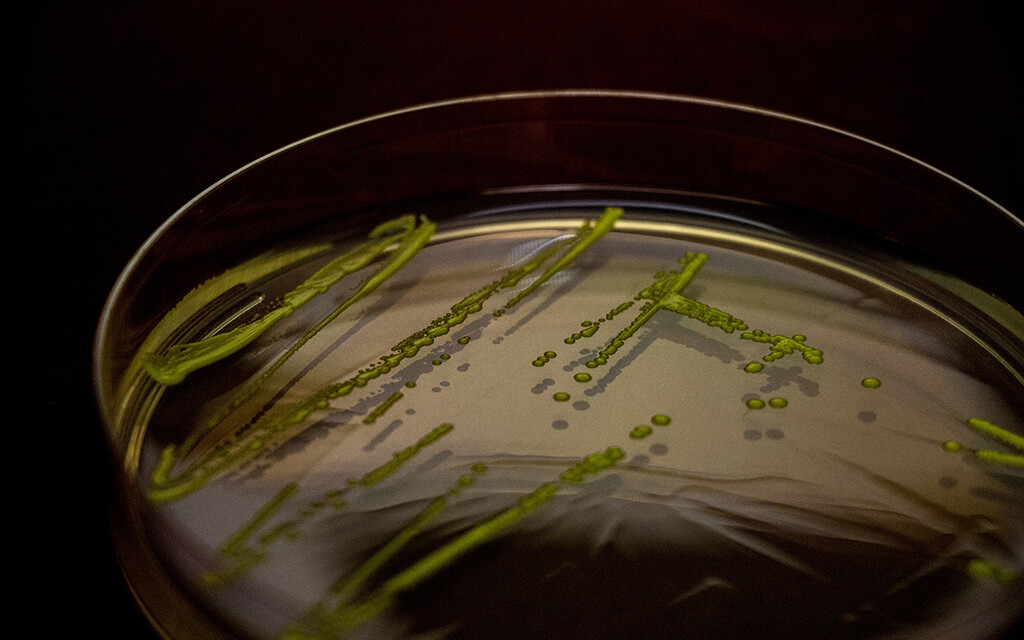 © Micrococcus von der ISS Nachweis der Mikroorganismen, © Med Uni Graz, Wink