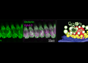Das Protein Otoferlin in den Sinneszellen des Innenohrs (links, in grün) © Strenzke et al., EMBO J 2016.