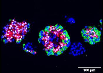 Menschliche Langerhans Inseln, mit 10 mM Artemisinin behandelt und immunofluoreszent gefärbt: Zellkern (blau), ARX (weiß), Glukagon (rot) und C-Peptid (grün). © Cell Press