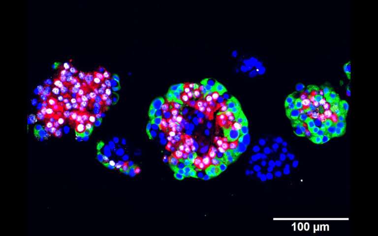 Menschliche Langerhans Inseln, mit 10 mM Artemisinin behandelt und immunofluoreszent gefärbt: Zellkern (blau), ARX (weiß), Glukagon (rot) und C-Peptid (grün). © Cell Press