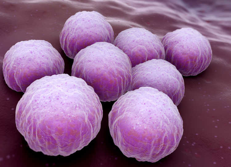 ChlamydienInfektionen und Gonorrhoe früh genug erkennen