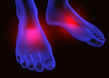 Bei der arteriellen Verschlusskrankheit pAVK treten im Stadium 3 Schmerzen in den Füßen und Zehen im Ruhezustand auf. © carlos castilla / shutterstock.com