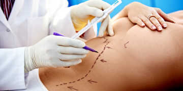 Auf Komplikationen bei Schönheitsoperationen hat der Chirurg oft nur bedingten bzw. oftmals überhaupt keinen Einfluss. © gtfour / shutterstock.com