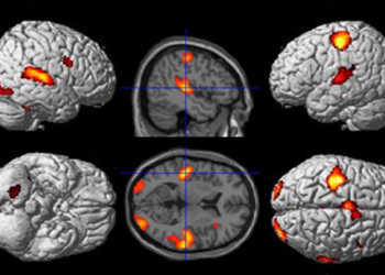 Die Hirnaktivität lässt sich farbig darstellen, wenn man das Hirn mittels Magnetresonanz-Tomografie durchleuchtet. © Abb.: Benjamin Straube