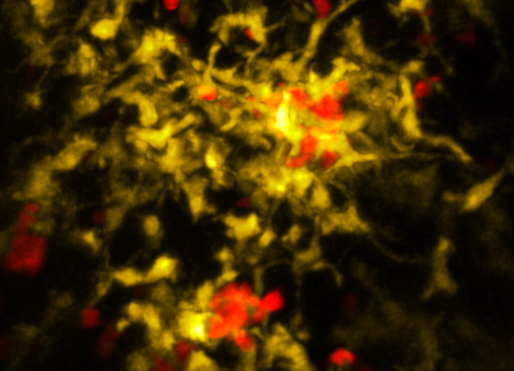 Sobald Killerzellen (rot) Wind von einer Infektion bekommen, rufen sie eine Art Mitarbeiterstab aus verschiedenen Immunzellen (grün bzw. gelb) zusammen. Erst in dieser Mikroumgebung werden sie vollständig aktiviert. © AG Kastenmüller / Universität Bonn