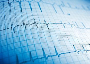 Bei den Schlaganfallpatienten, die das Langzeit-EKG bekamen, gab es etwa 40 Prozent weniger erneute Schlaganfälle und Schlaganfallvorstufen. © pedrosala / shutterstock.com