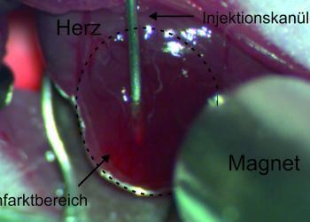 Über eine in das Infarktareal eingebrachte Kanüle werden die mit magnetischen Nanopartikeln beladenen Zellen in das geschädigte Herzmuskelgewebe der Maus gespritzt. © Foto: Dr. Annika Ottersbach / Uni Bonn