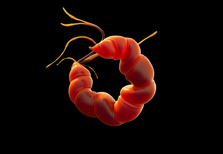 Helicobacter pylori-Infektionen beeinflussen Mikrobiom - MedMix