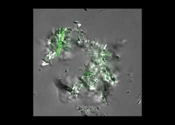 Fluoreszenzmikroskopische Aufnahme von DMN-Trehalose gefärbte Mycobacterium tuberculosis-Zellen. © Mireille Kamariza / Stanford University