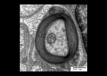 Elektronenmikroskopisches Bild der das Axon konzentrisch umgebenden Myelinscheide. © Wikimedia Commons